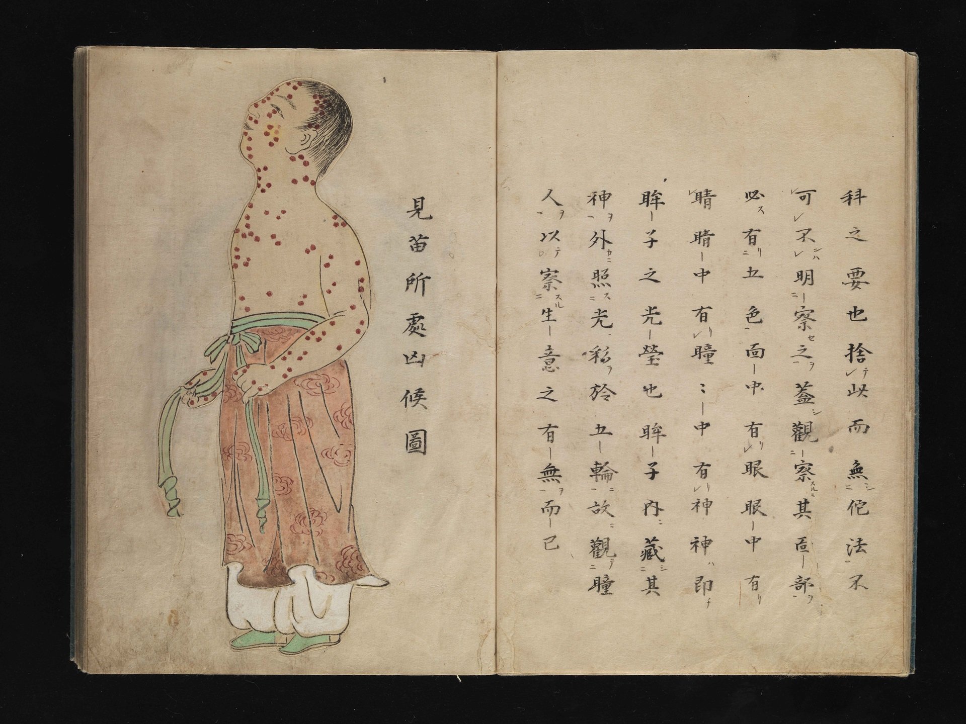 Ancient Japanese illustration of smallpox